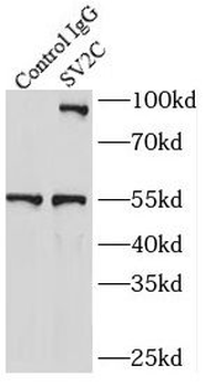 SUZ12 Antibody