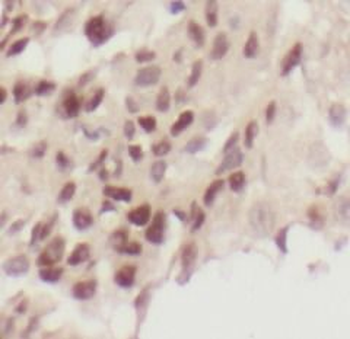 SUZ12 Antibody