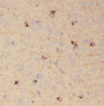 SV2B Antibody