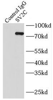 SV2C Antibody