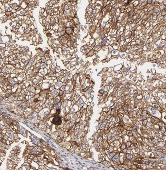 SYAP1 Antibody