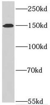 SYMPK Rabbit Polyclonal Antibody