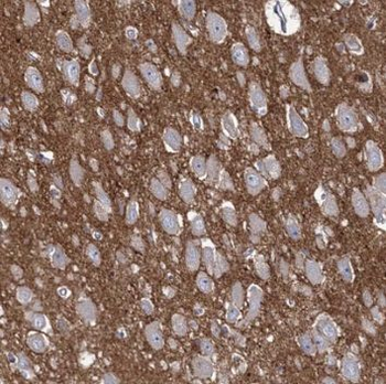 SYNPO Antibody