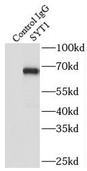 SYT1 Antibody