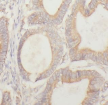 SDC3 Antibody