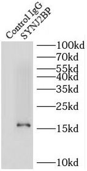 SYNJ2BP Antibody