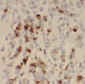 SYNJ2BP Antibody