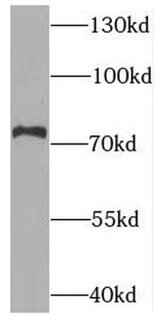 SNPH Antibody