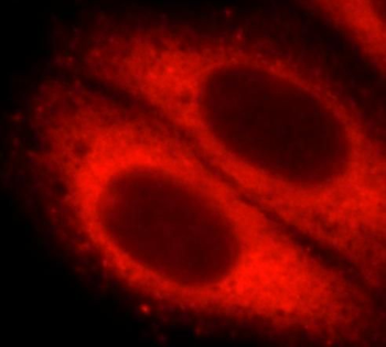 STX12 Antibody