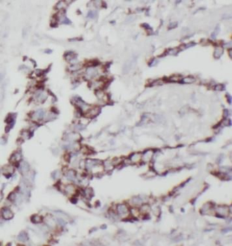 STX12 Antibody