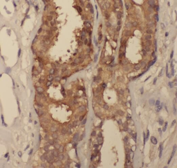 SDCBP2 Antibody