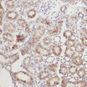 SYVN1 Antibody
