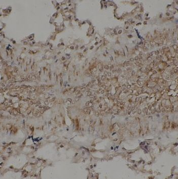 TAB1 Antibody