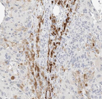 TAB2 Antibody