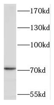 TACC2 Rabbit Polyclonal Antibody