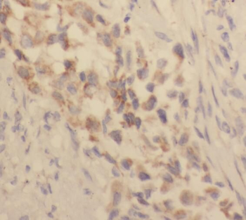 TACC2 Antibody