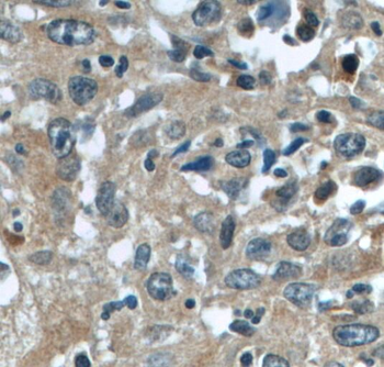 TACC3 Antibody