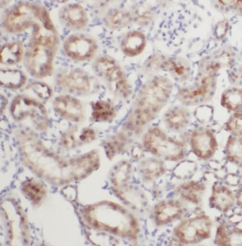 TACO1 Antibody