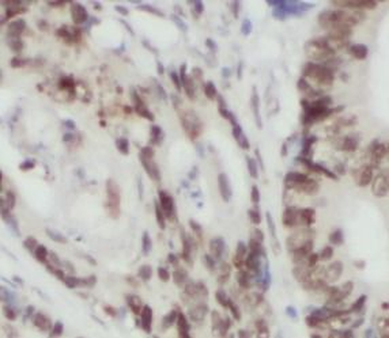 TAF15 Antibody