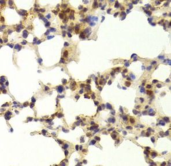 TAF1C Antibody