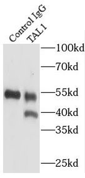 TAL1 Antibody