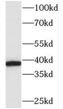 TALDO1 Rabbit Polyclonal Antibody