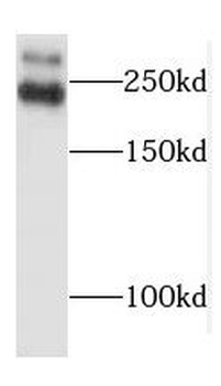 TLN1 Rabbit Polyclonal Antibody
