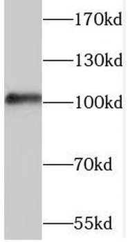 TAOK3 Antibody