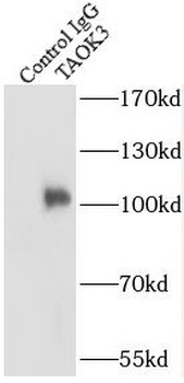 TAOK3 Antibody