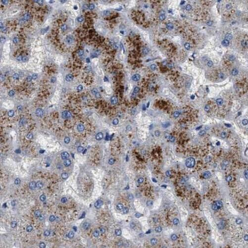 TAOK3 Antibody
