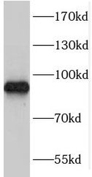 TARS3 Rabbit Polyclonal Antibody