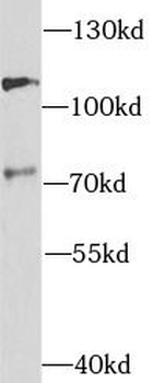TAU Rabbit Polyclonal Antibody