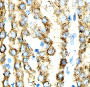 TAU Rabbit Polyclonal Antibody