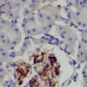 TAX1BP3 Antibody