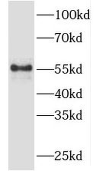 TBC1D19 Rabbit Polyclonal Antibody