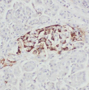 TBC1D19 Antibody