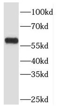 TBC1D22A Antibody