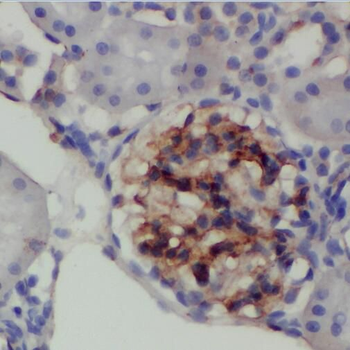 TBC1D22A Antibody