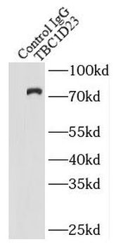 TBC1D23 Antibody
