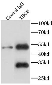 TBCB Antibody
