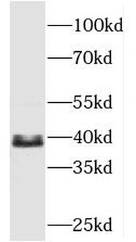 TBCC Rabbit Polyclonal Antibody