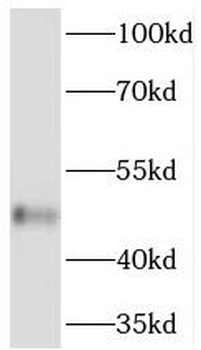 TBL2 Rabbit Polyclonal Antibody