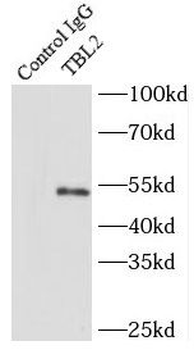 TBL2 Rabbit Polyclonal Antibody