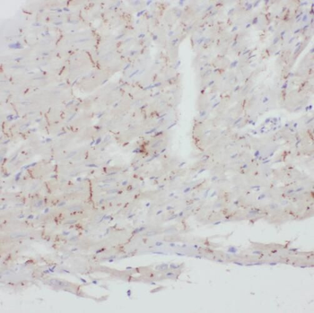 TBL2 Rabbit Polyclonal Antibody