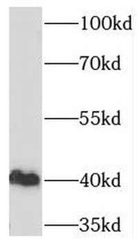 TBP Rabbit Polyclonal Antibody