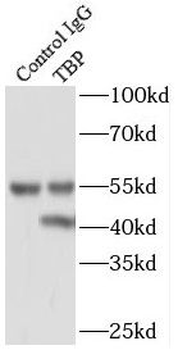 TBP Rabbit Polyclonal Antibody