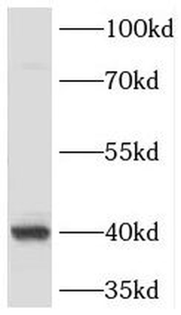 TBP Rabbit Polyclonal Antibody