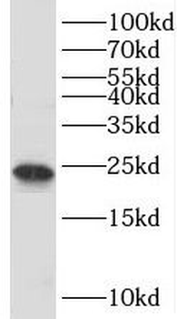 TBPL1 Antibody