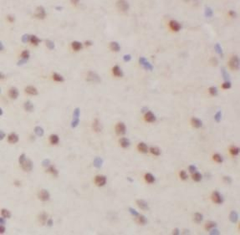 TBR1 Antibody