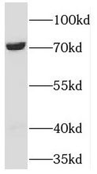 TBRG4 Antibody